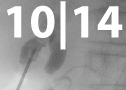 14-05