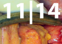 14-05