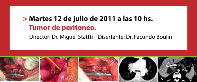 Tumor de peritoneo