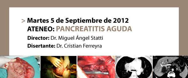 ATENEO: PANCREATITIS AGUDA