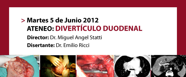 ATENEO: Divertículo Duodenal