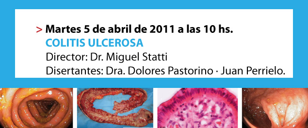 ATENEO SOBRE COLITIS ULCEROSA